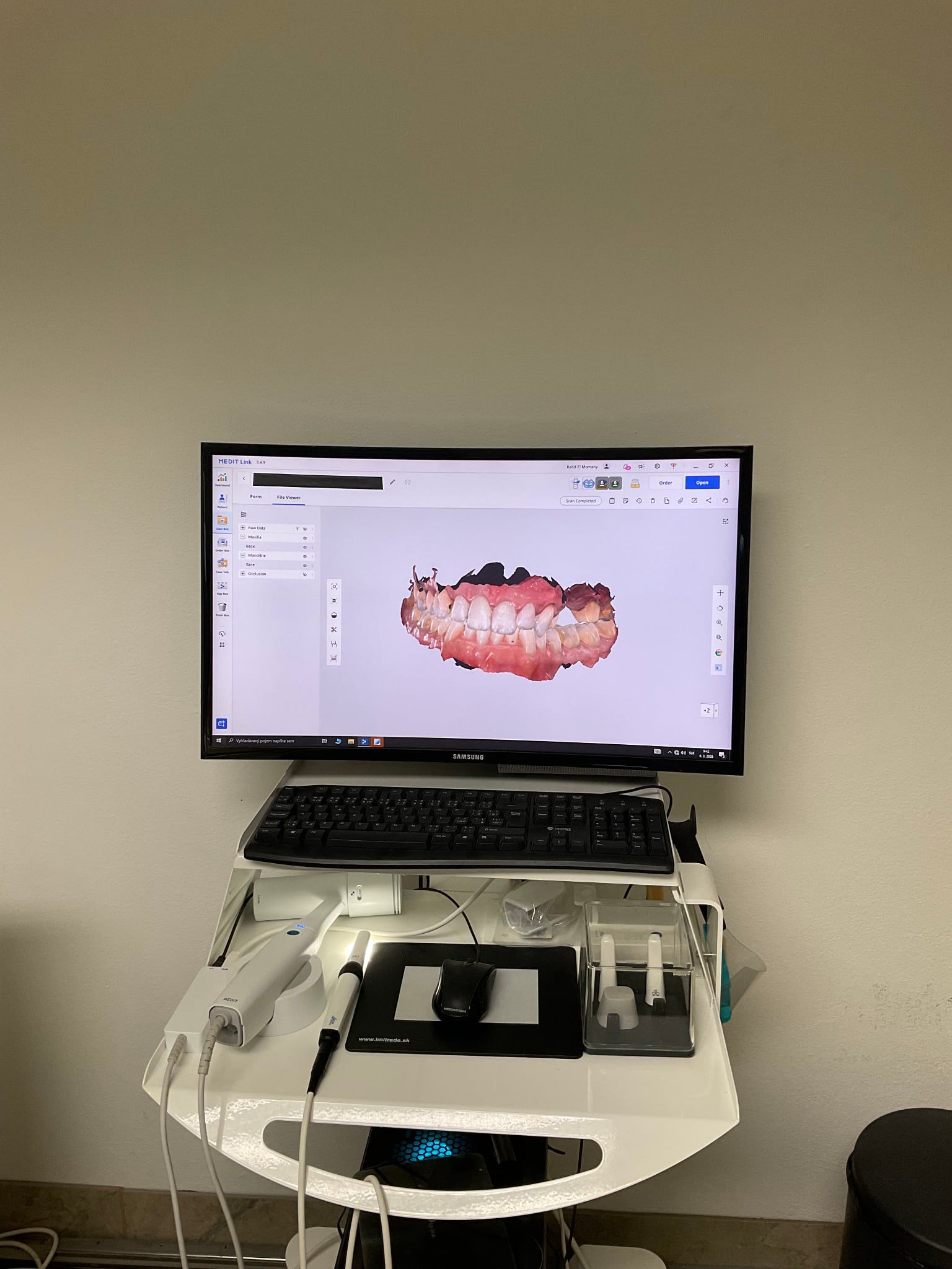 Digitálny skener a 3D zobrazenie zubov